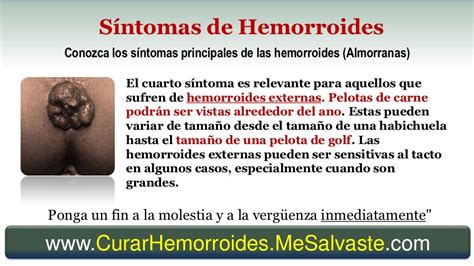 Hemorroides externas [almorranas]: qué son, síntomas y cómo。